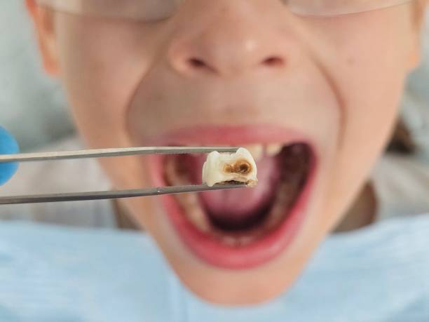 Best Pediatric Emergency Dentist in Catasauqua, PA